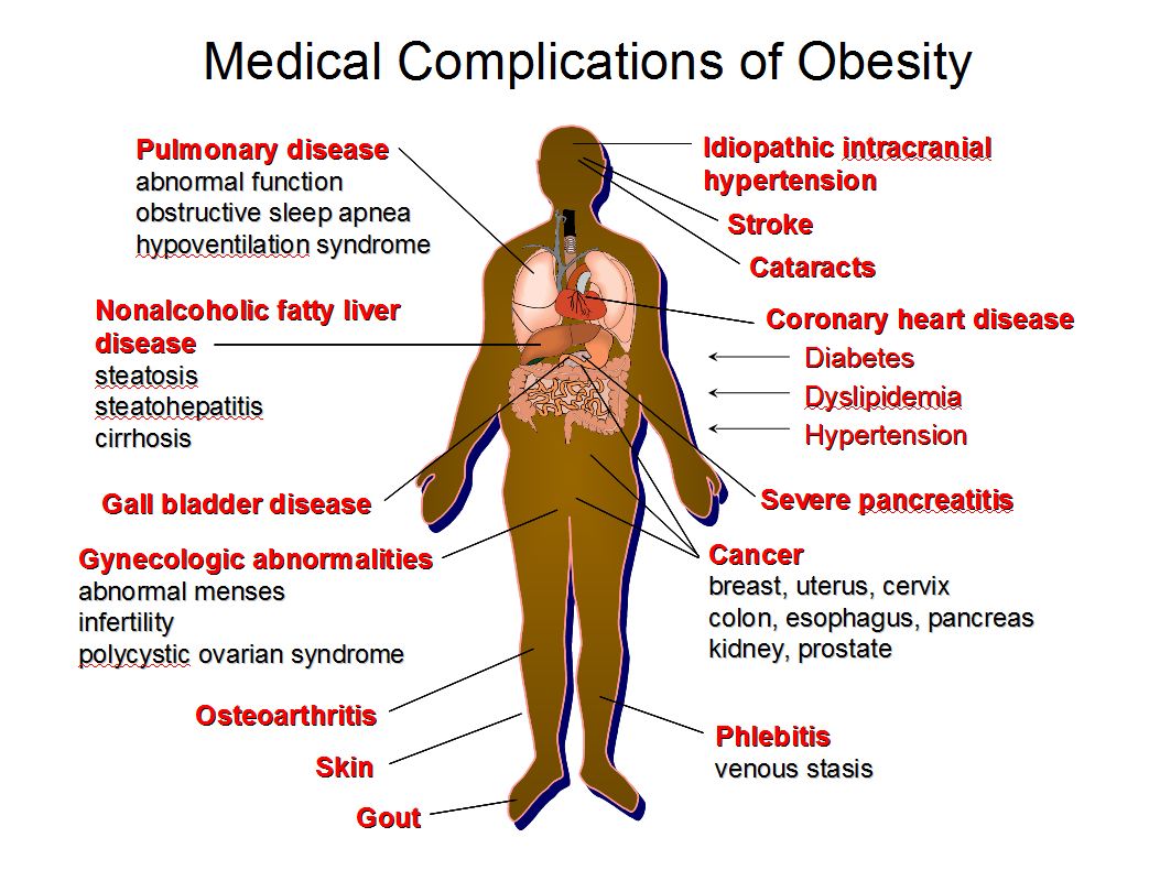 how-will-obesity-rates-in-the-future-affect-your-healthcare-career