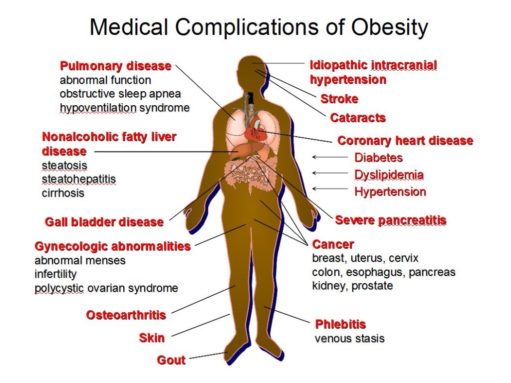 MedicalComplicationsofObesity